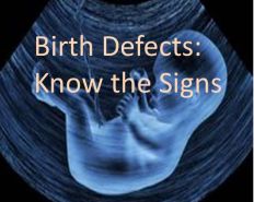 Birth.Defects